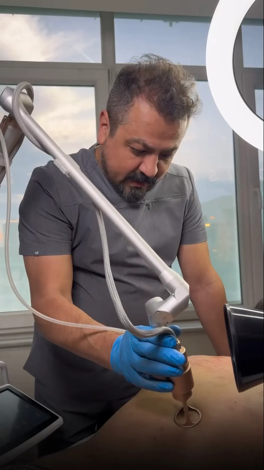 Akne İzi Tedavisi
